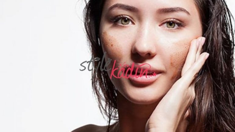 Sivilce İzleri İçin Çözüm Önerileri