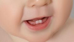 Bebeklerde Önce Hangi Diş Çıkar? Bebeklerde Diş Çıkarma Sırası Nasıldır?