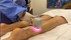 Buz Lazer ile mükemmel deneyim, tüylerinizden en konforlu şekilde kalıcı kurtuluş!