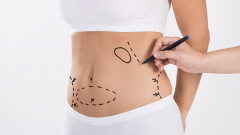 Liposuction ve Estetik Yöntemleri