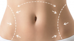 Karın Germe Ameliyatı (Abdominoplasty)