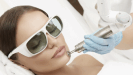 Fraksiyonel Lazer Nedir? Cilt Yenilemede Yeni Nesil Teknoloji